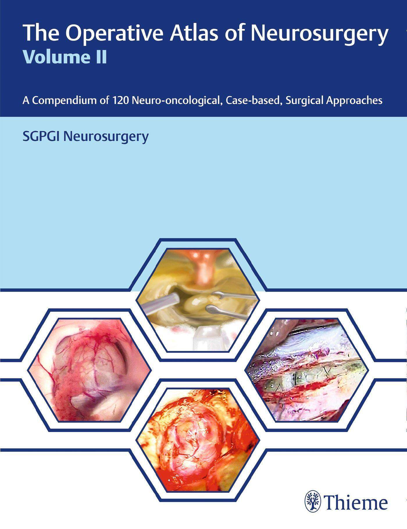 Monheimer　The　Neurosurgery,　II　Lokalhelden　Operative　of　Atlas　Vol