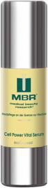 Serum MBR