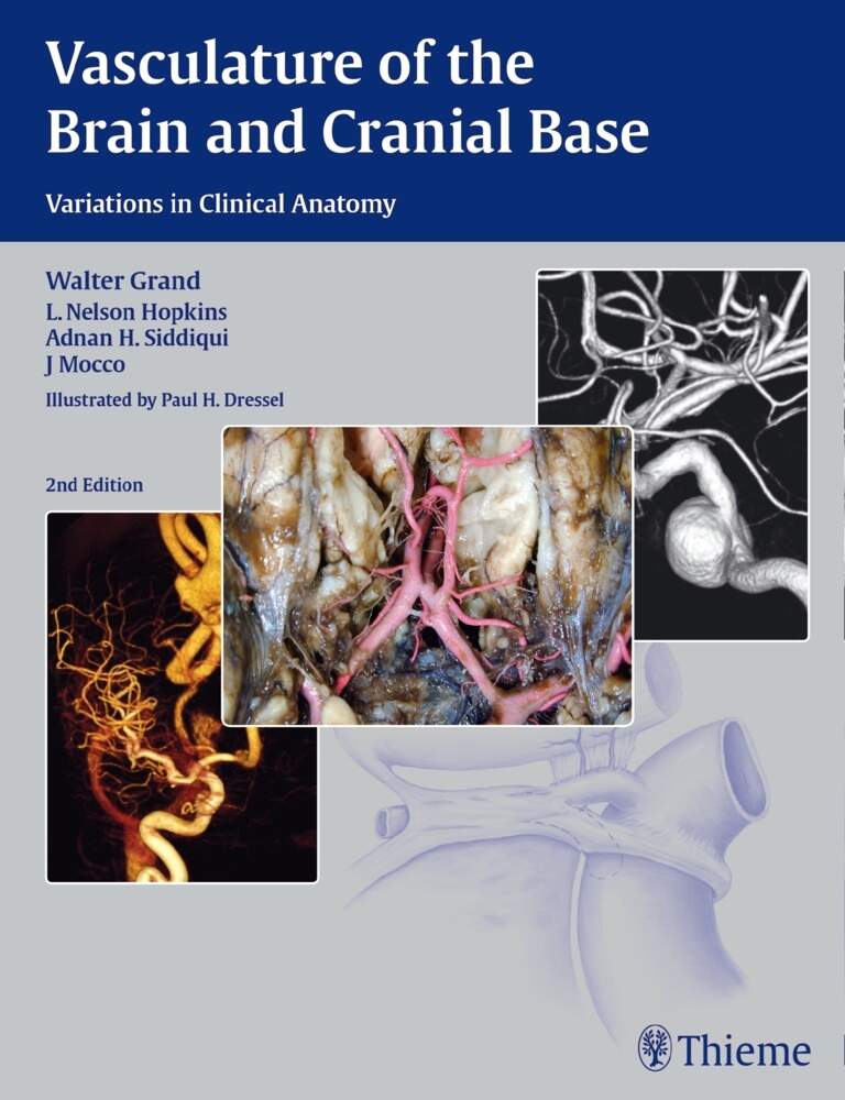 J.　Hopkins,　the　Cranial　Base　Nelson;　Mocco,　and　Walter;　H.;　Brain　Siddiqui,　Adnan　Wir-In-Günzburg　Grand,　of　Vasculature　L.